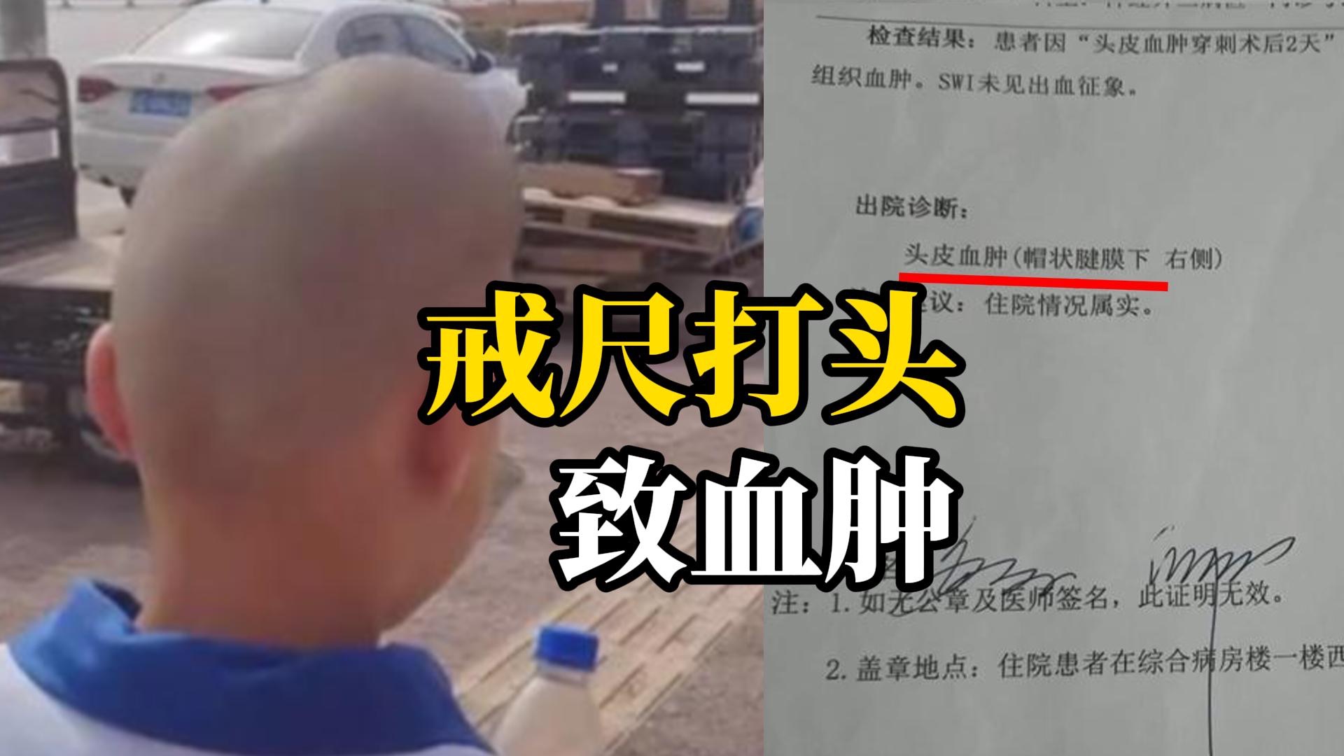 小学生课本丢失被老师用戒尺打头致头部血肿变形