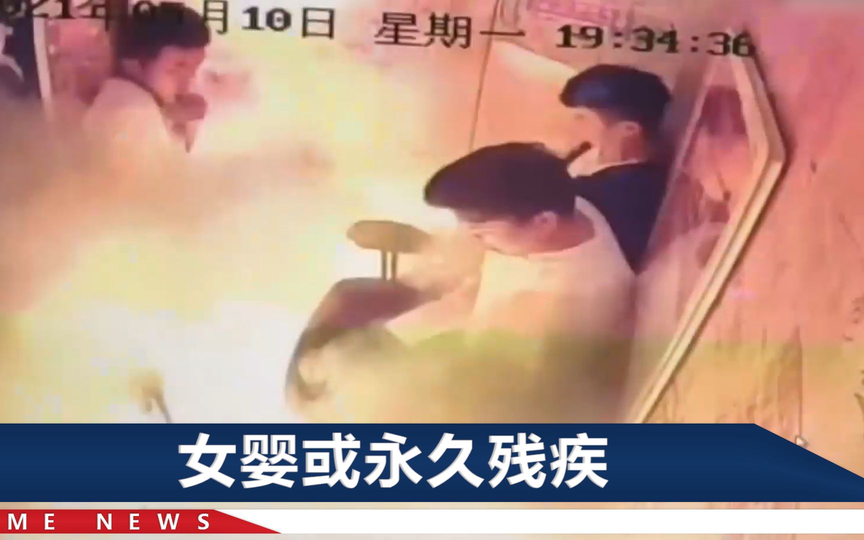 成都一电梯内电瓶车爆燃致女婴烧伤，父亲：她只剩2个完整手指