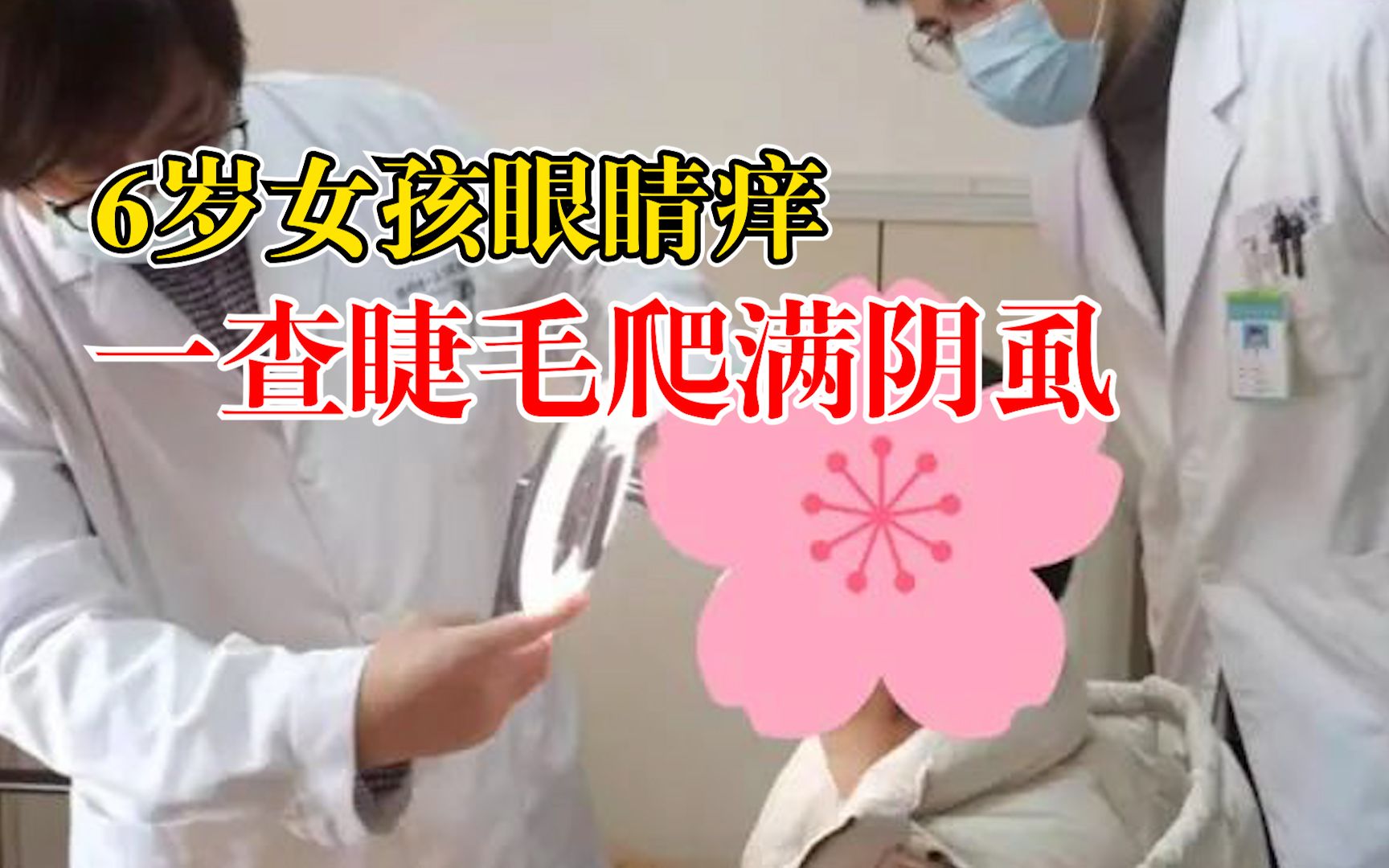 6岁女孩眼睛痒一查睫毛爬满阴虱：眼皮出血，睫毛上有血性分泌物