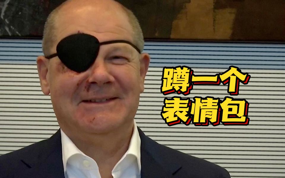 这不得安排一个？朔尔茨摔伤后晒“海盗照” 调侃称期待看到表情包