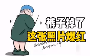 90后医生手术时裤子掉了浑然不知