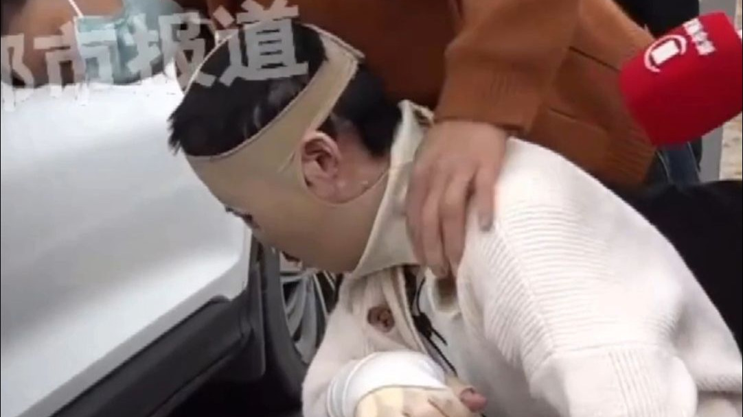 女生拒复合遭前男友泼汽油烧残，今日二审开庭，当事人路上闻到汽油味直犯恶心
