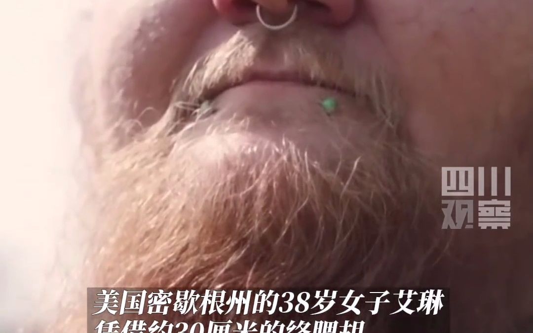 因患病长胡子干脆蓄须，美国女子凭30厘米络腮胡打破吉尼斯世界纪录