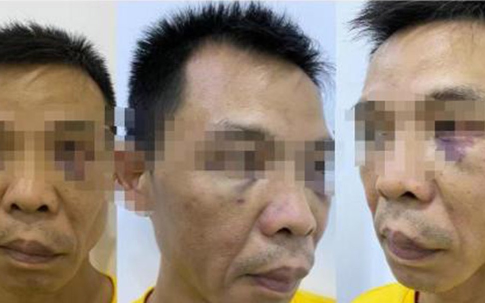 男子发文称被副局长锁家中殴打、其妻被拽头撞墙 纪委：正积极跟进