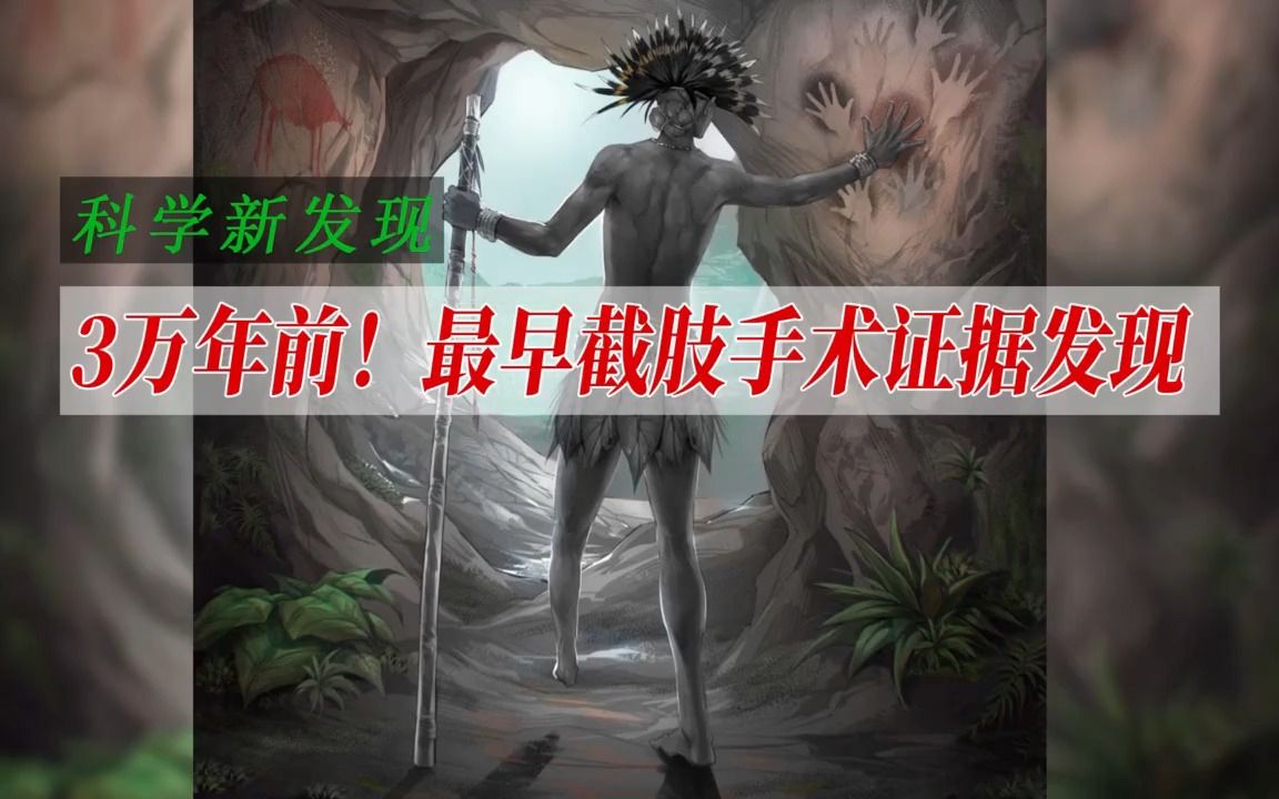 3万年前！最早截肢手术证据发现