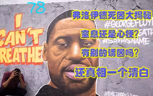 死者代言：弗洛伊德的真实死因是心衰？有别的诱因吗？