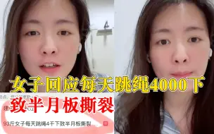 女子回应每天跳绳4000下致半月板撕裂：大家一定要科学减肥