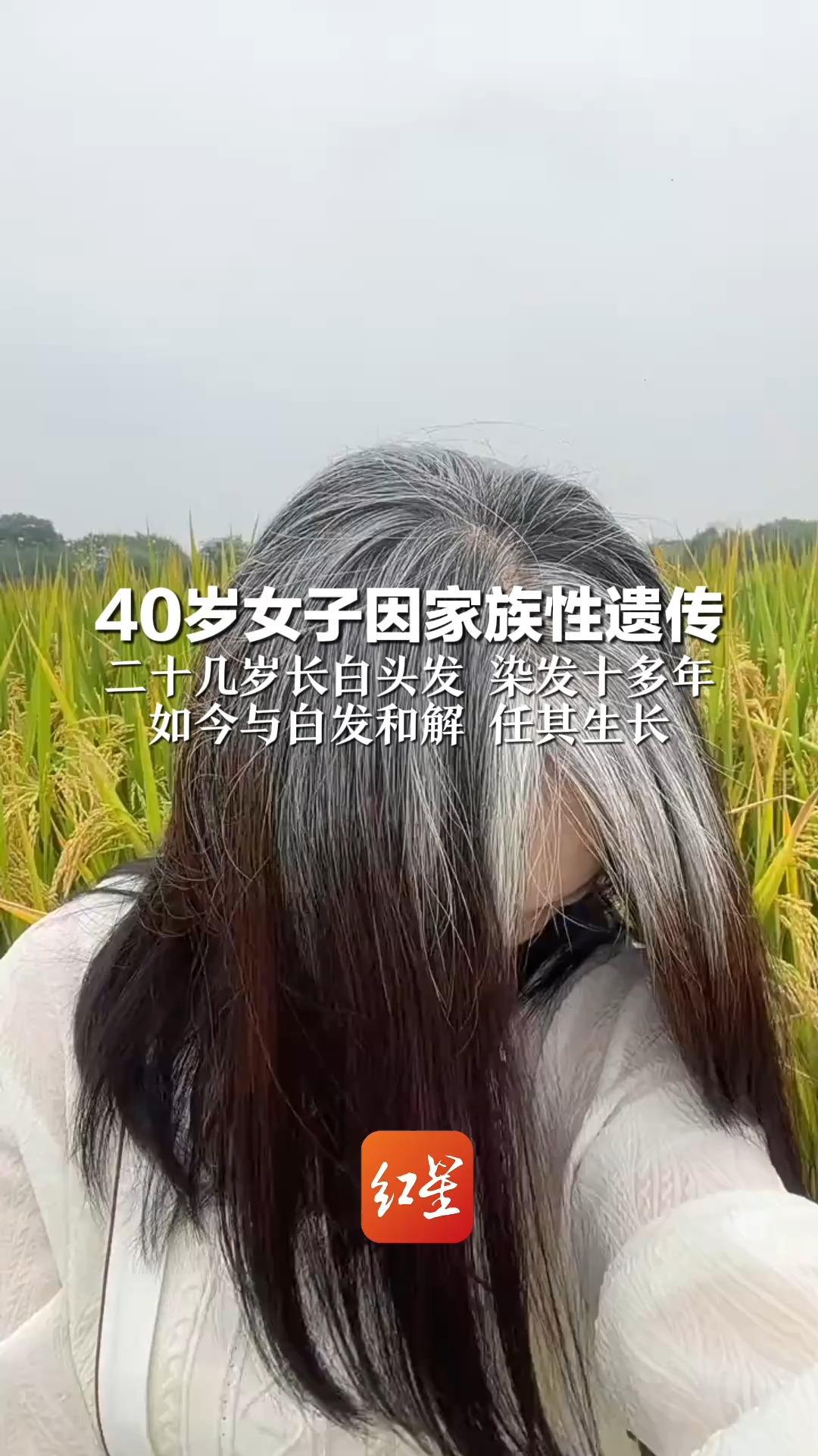 40岁女子因家族性遗传 二十几岁长白头发 染发十多年 如今与白发和解 任其生长