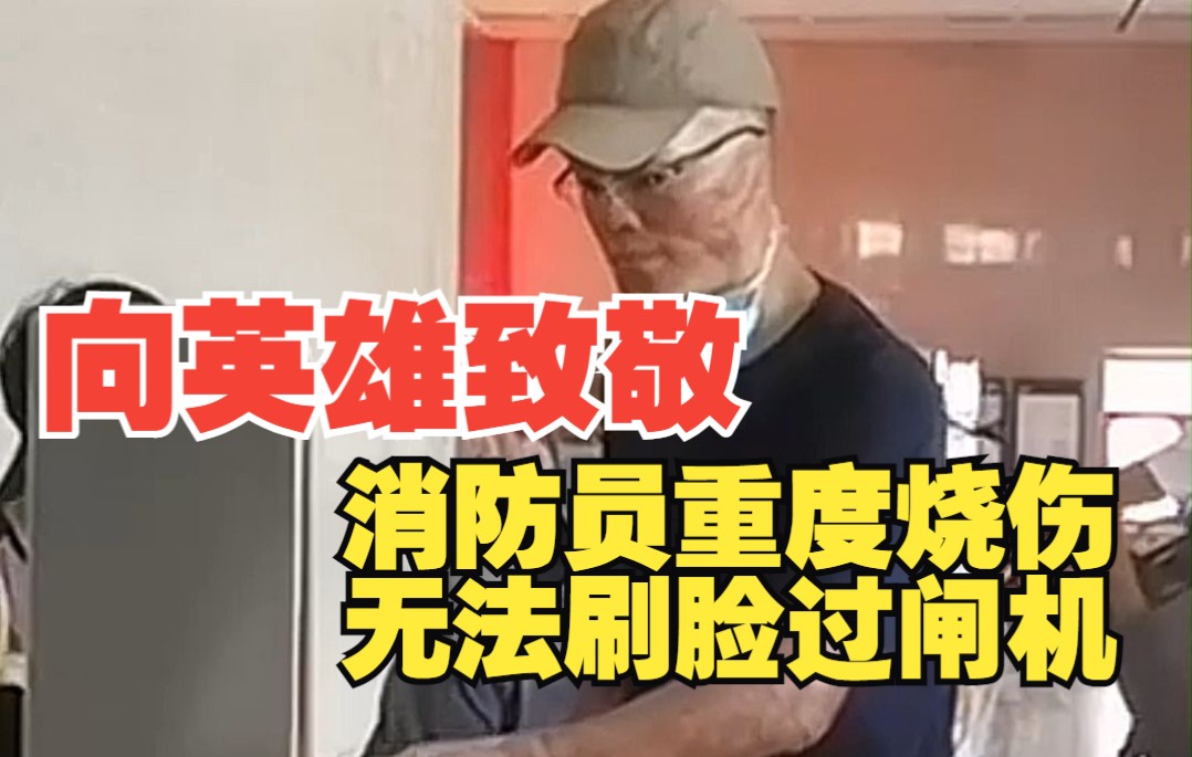 消防员重度烧伤无法刷脸过闸机 “我们4个都烧伤了，只有我活了下来”
