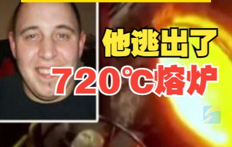 人类求生极限有多高？瑞士一工人跌入720℃熔炉爬出生还