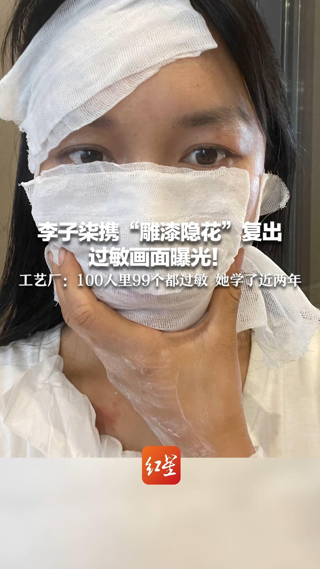 李子柒携“雕漆隐花”复出 过敏画面曝光！ 学艺工艺厂：100人里99个都过敏 她学了近两年