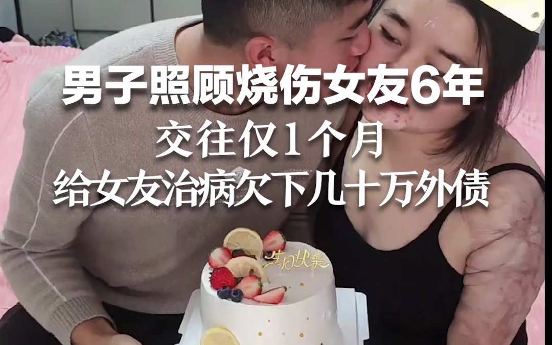 女子全身烧伤达90%，交往1个月的男友不离不弃照顾6年。女子：他每天给我按摩、涂药，从来没说过累，很心疼我。
