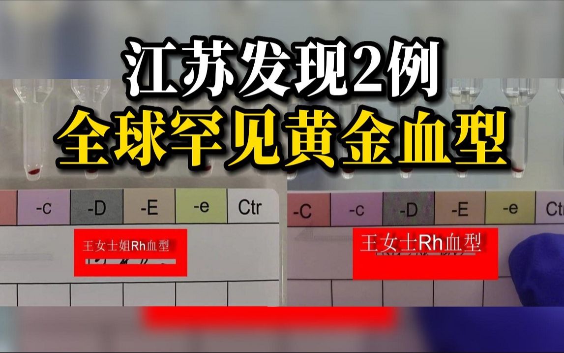 江苏发现2例罕见黄金血型，全球不足50例