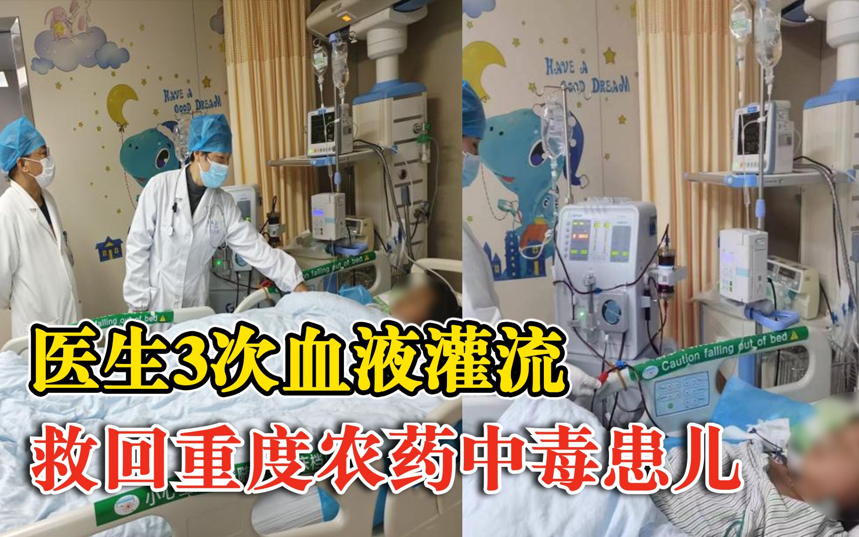 患儿误服农药3次血液灌流救一命：误服有机磷农药，致重度中毒