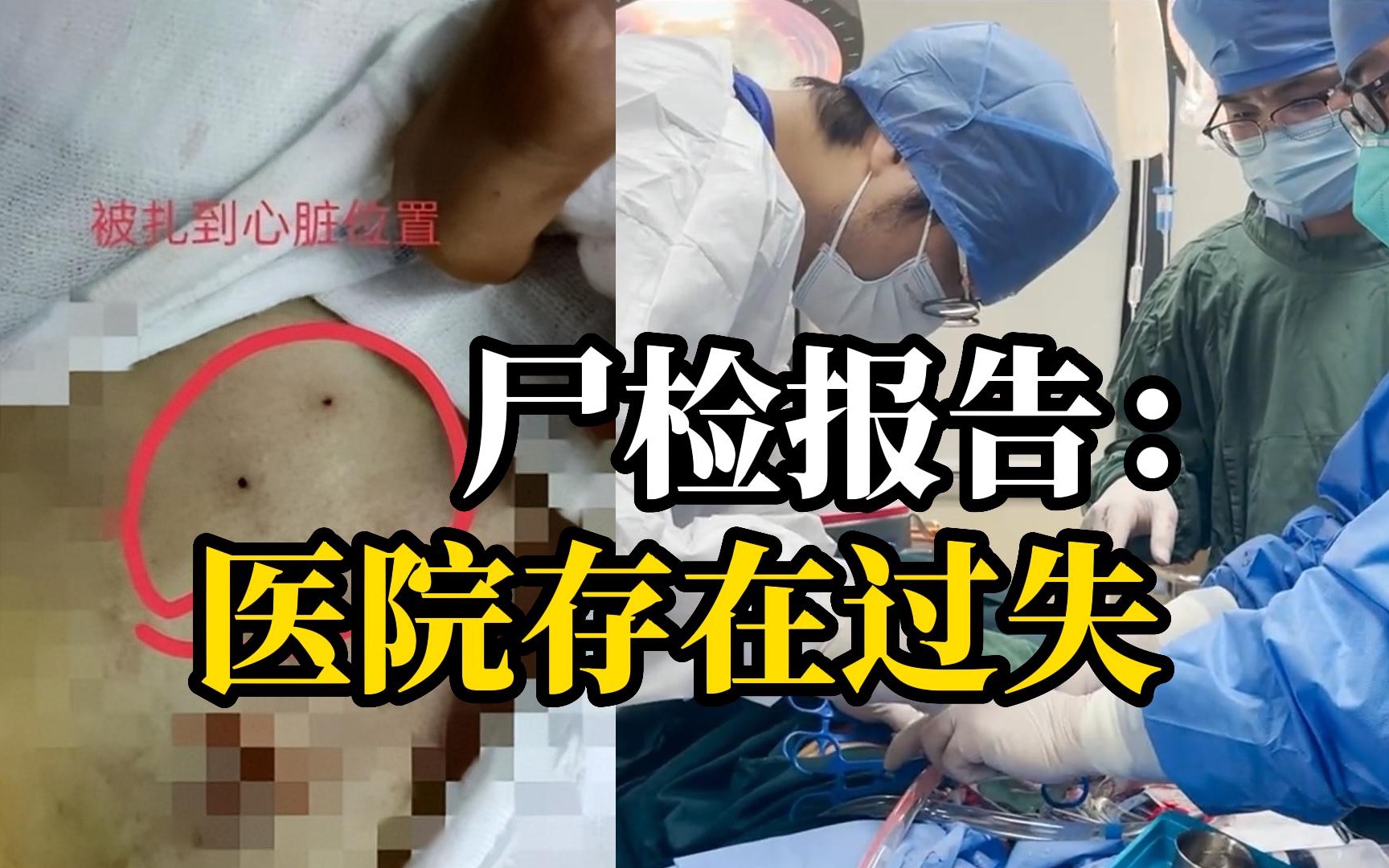 4岁女童穿刺死亡，父亲怀疑医生操作失误