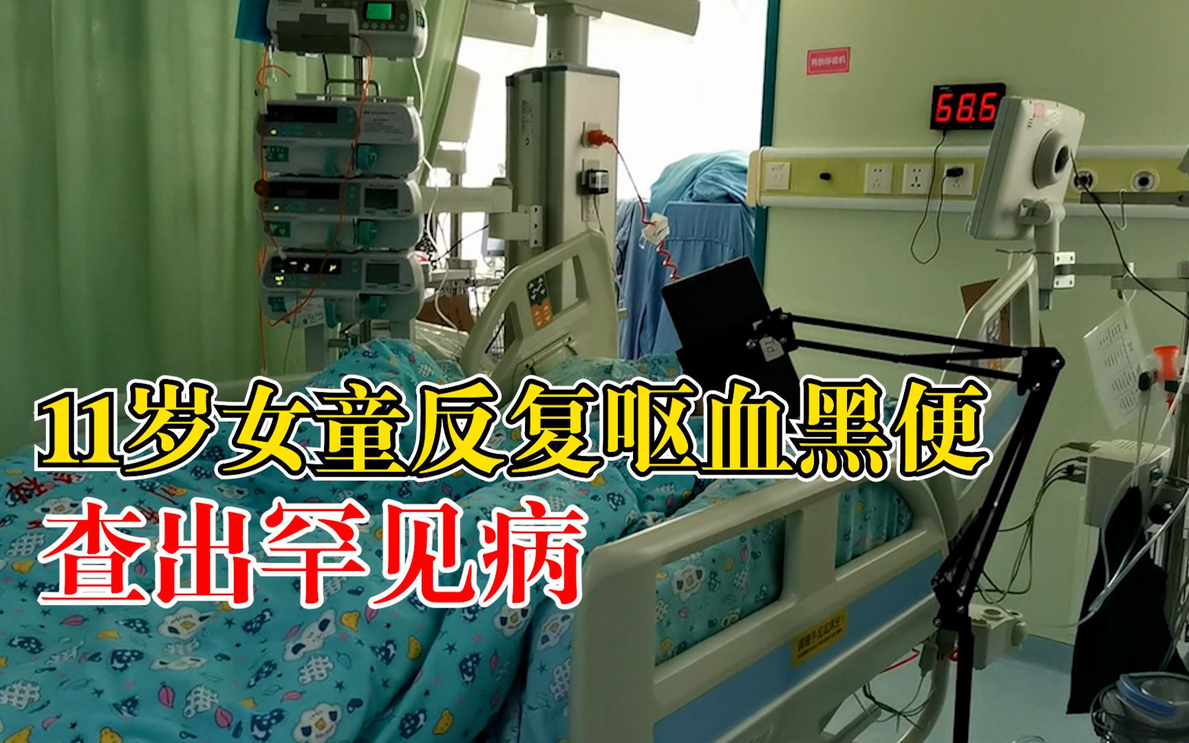 11岁女孩反复呕血黑便查出罕见病，医生从其颈部取静脉搭桥救治