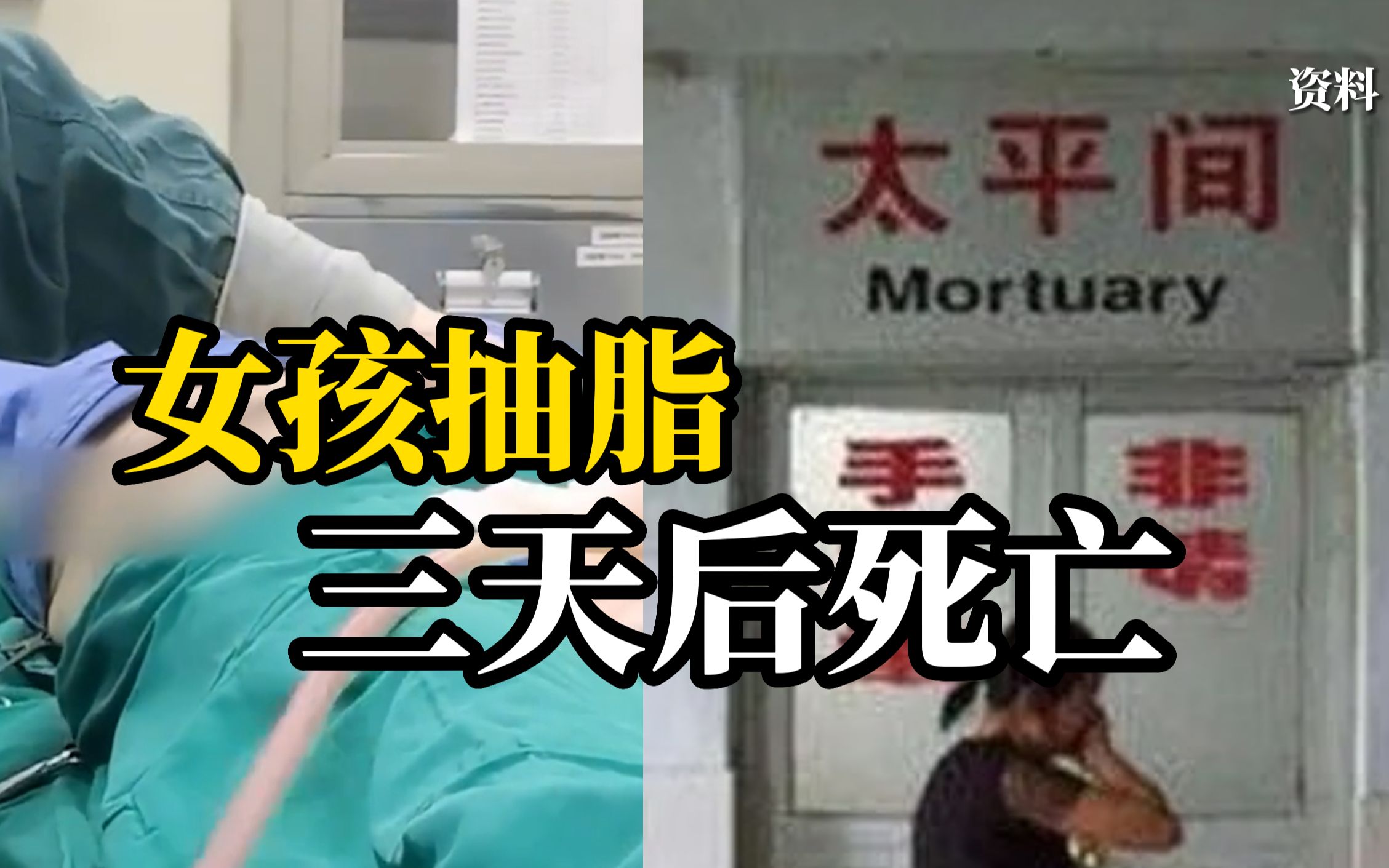 19岁女孩瞒着父母做抽脂，术后3天死亡。抽脂医生竟是助理，最终被判有期徒刑十个月