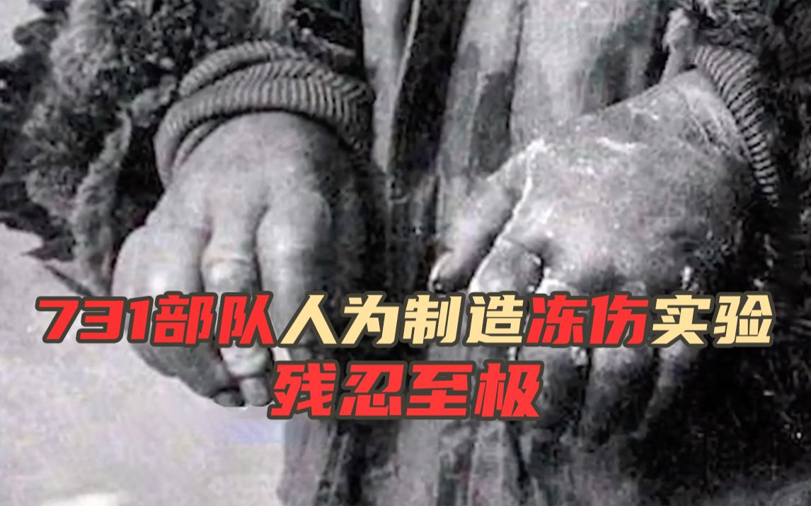 731部队人为制造冻伤实验残忍至极