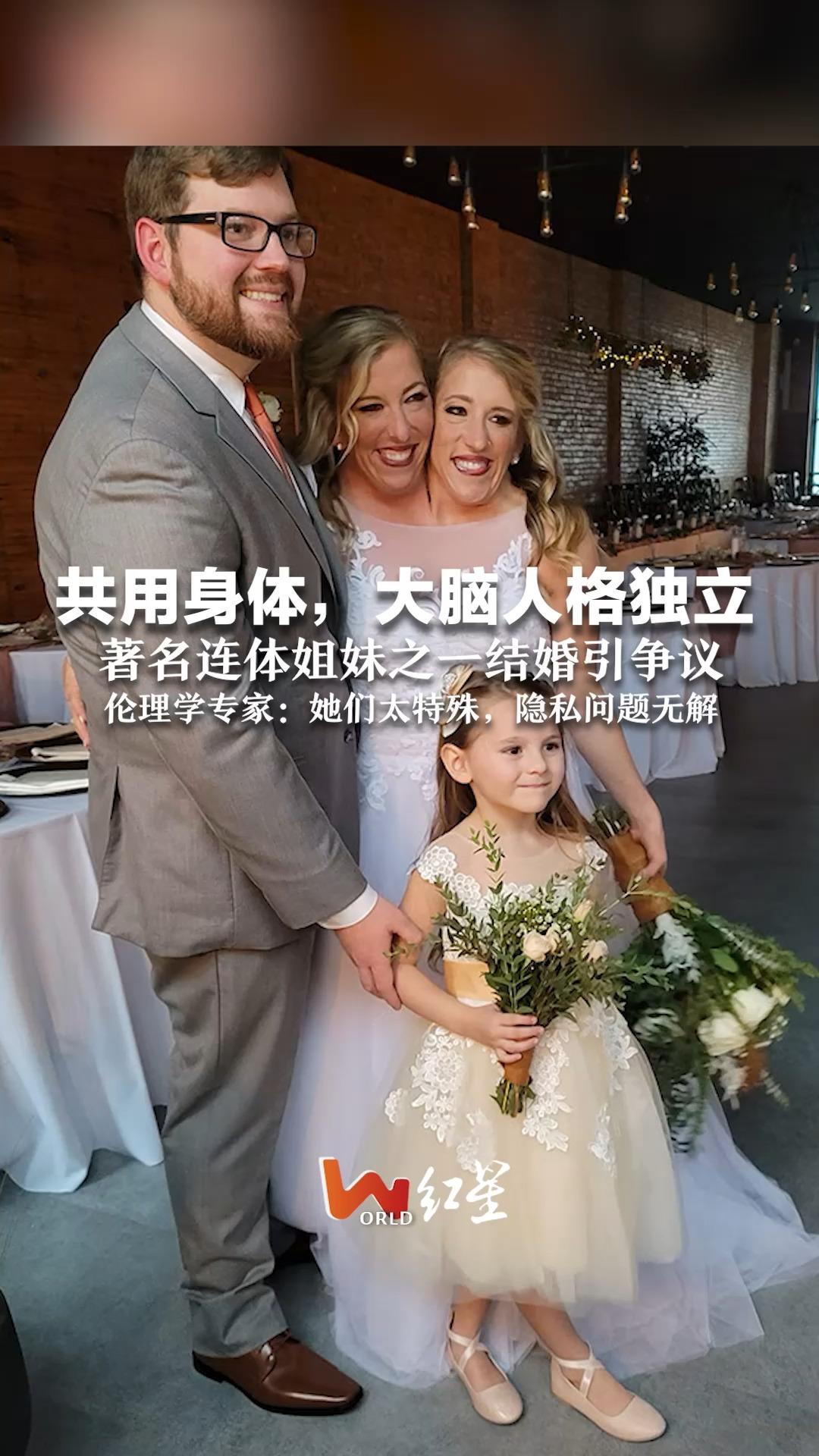 共用身体，大脑人格独立 著名连体姐妹之一结婚引争议 伦理学专家：她们太特殊，隐私问题无解