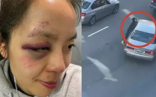 又一起！美国一亚裔女子街头遭3名劫匪抢劫 还被轿车拖行重摔