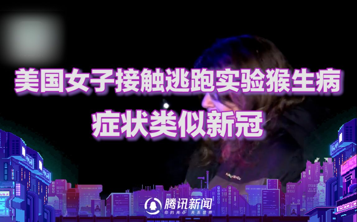 美国女子接触逃跑的实验猴子后生病 症状类似新冠
