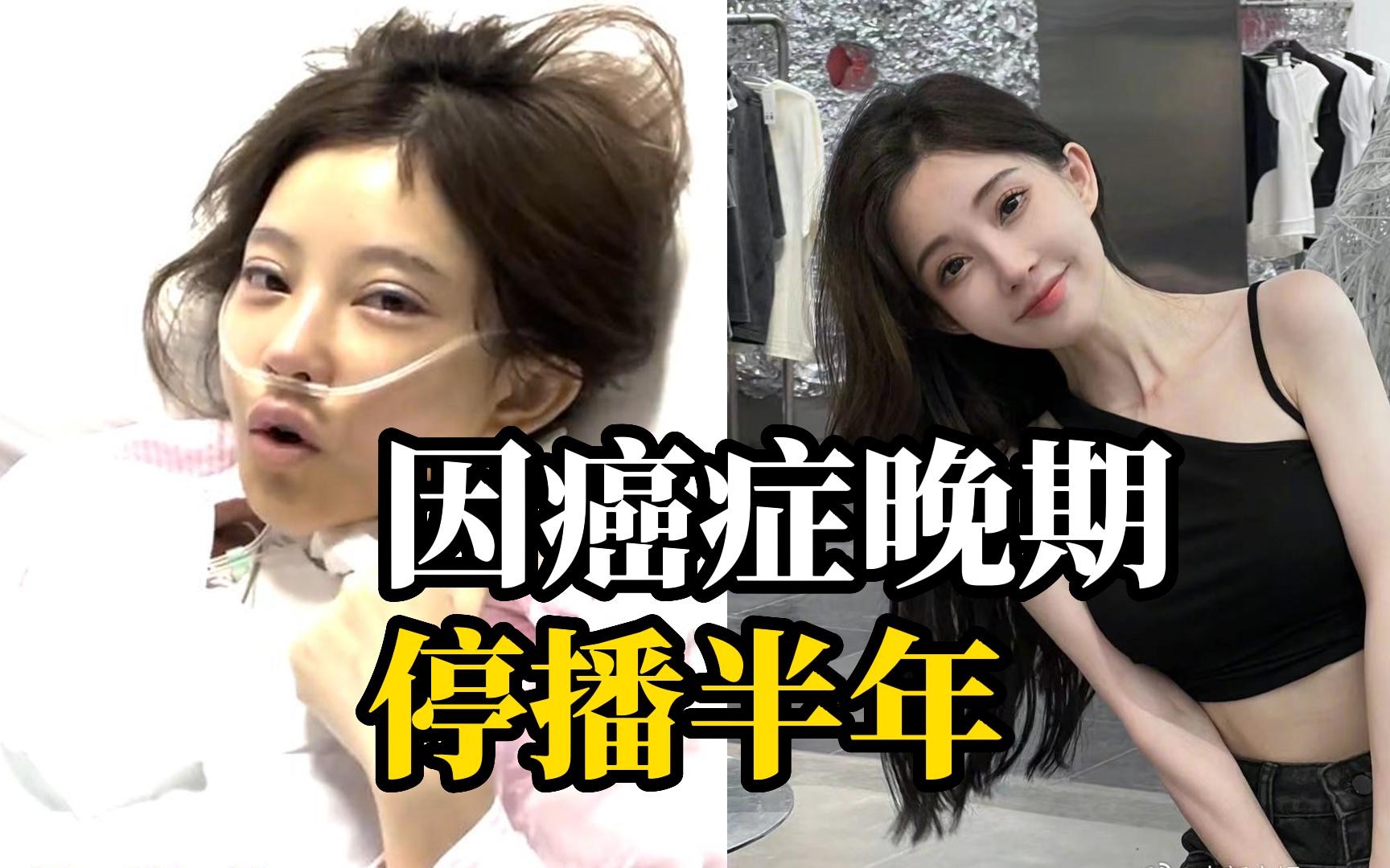 冯提莫因患甲状腺癌晚期停播半年，经过坚持不懈地训练嗓音已恢复正常