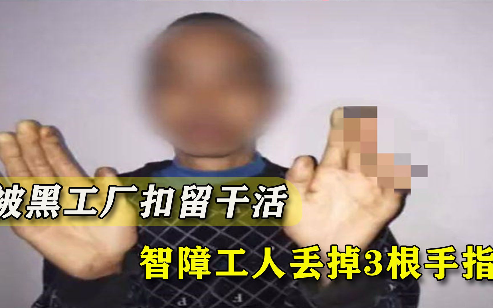警方解救智障“奴工”：凌晨开工断绝外界往来，3根手指都没了