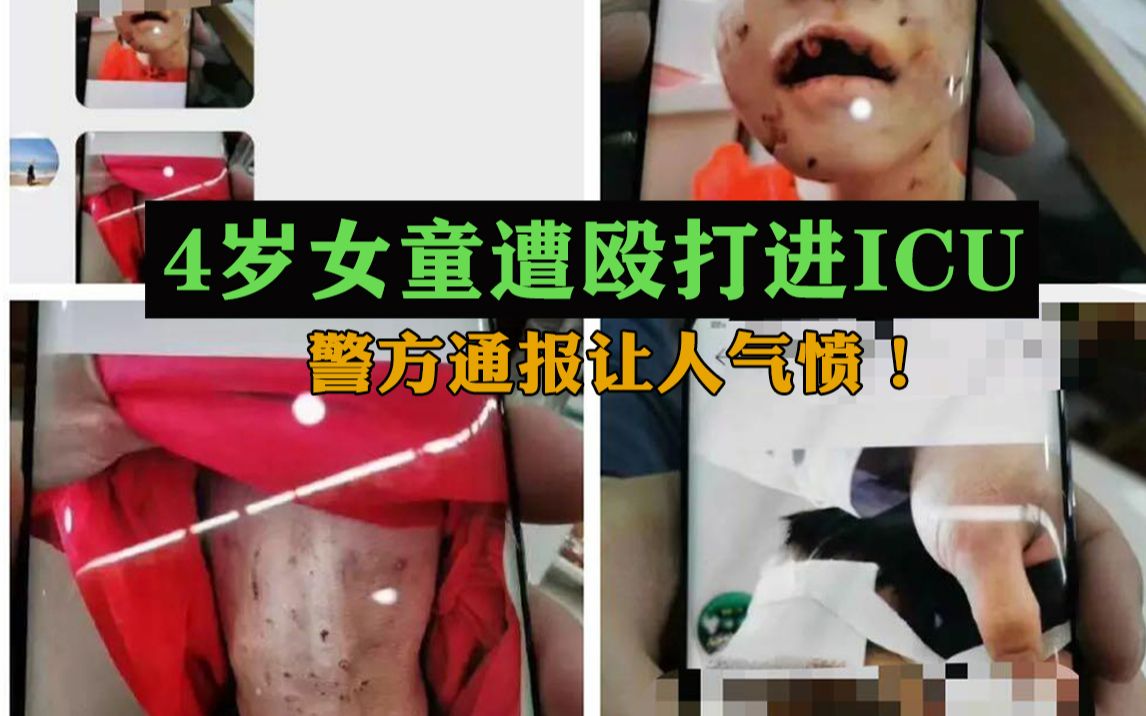 4岁女童遭殴打进ICU，重度昏迷危急生命，警方：生父也曾参与虐打，女童继母、生父均被刑拘！