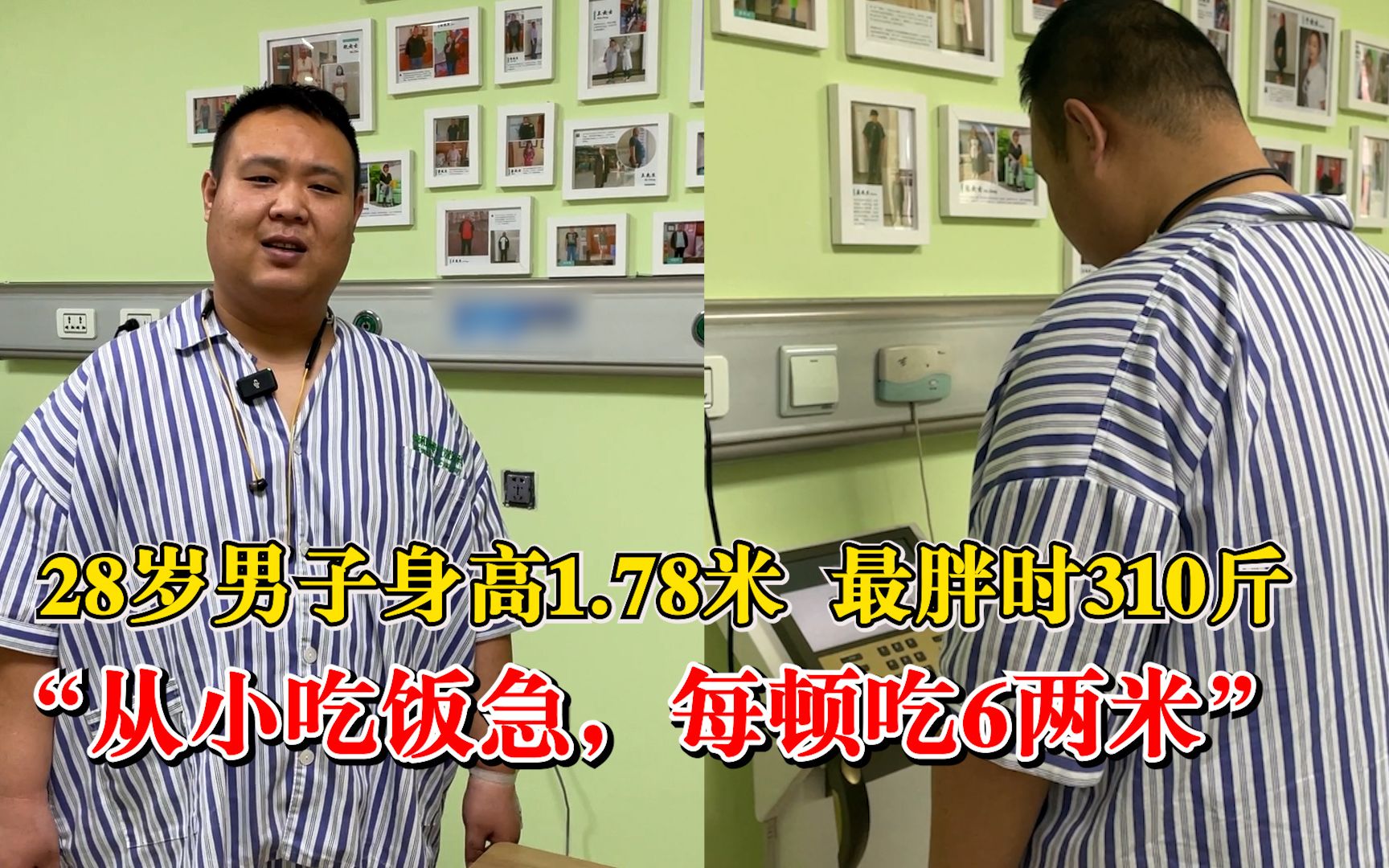 28岁男子身高178最胖时310斤：从小吃饭急，每顿能吃6两米