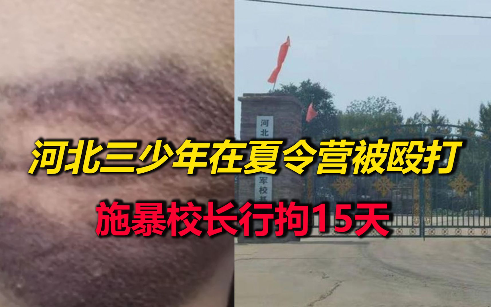 暴力夏令营！河北三少年被殴打至吐血，施暴校长行拘15天