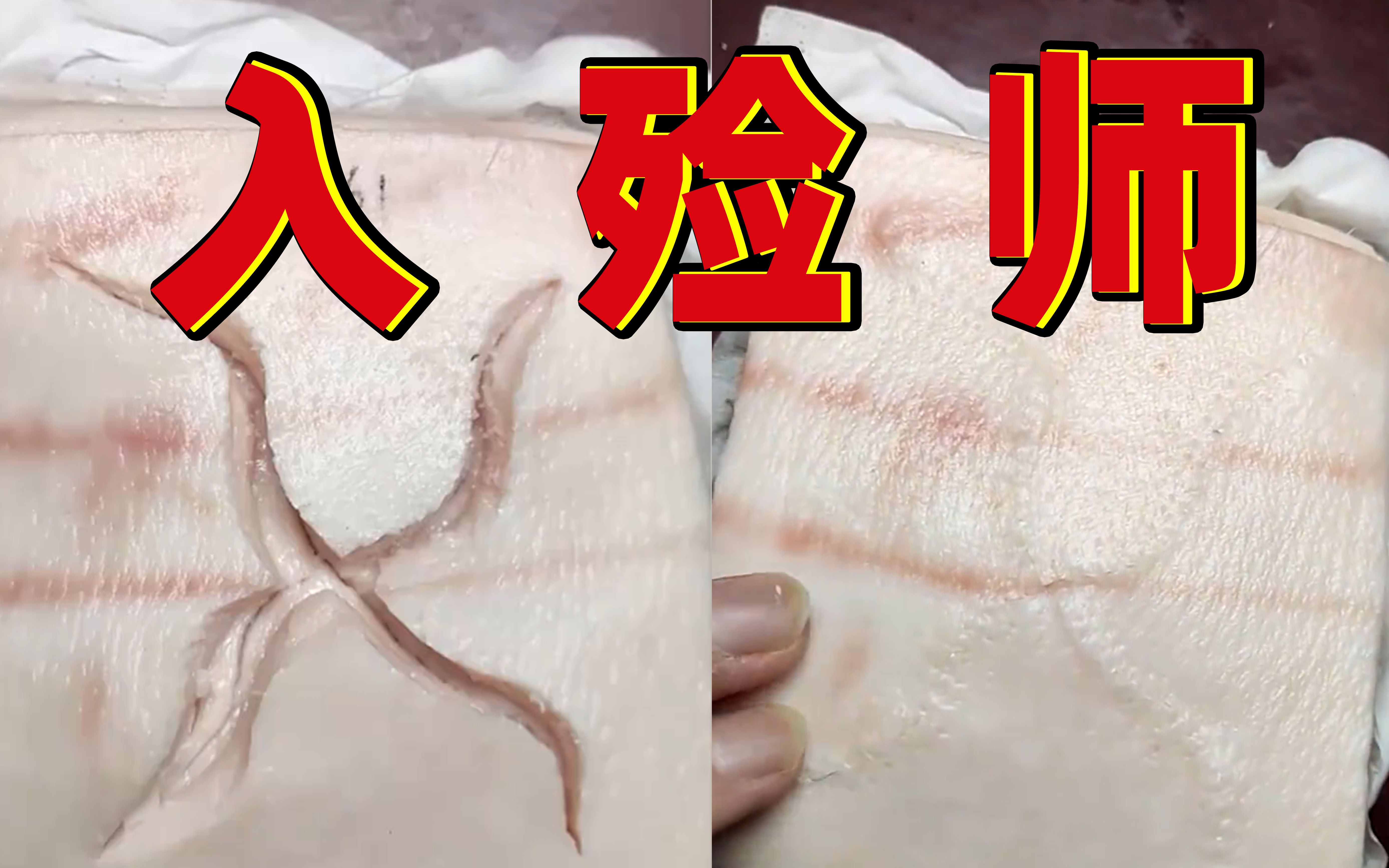 入殓师用猪皮苦练缝合 只想给人最后的体面