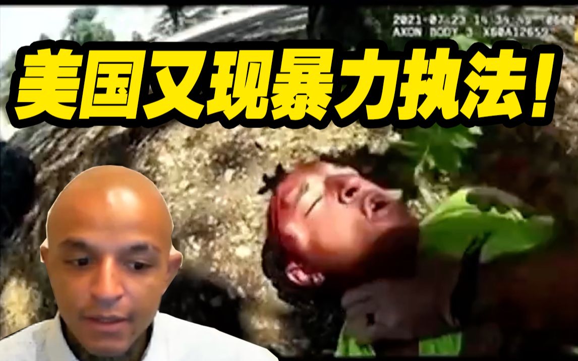 受害者回忆美国暴力执法：没有反抗却一直被打