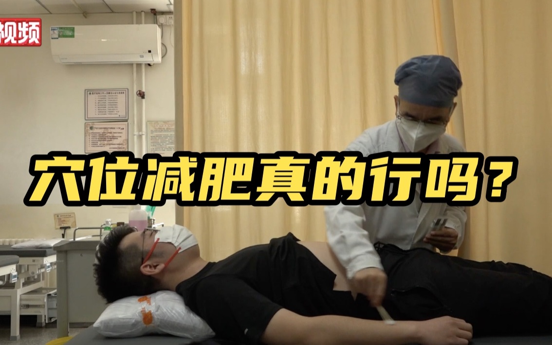 【小新的vlog】穴位减肥真的行？小新“奉献”小肚腩体验针灸减肥