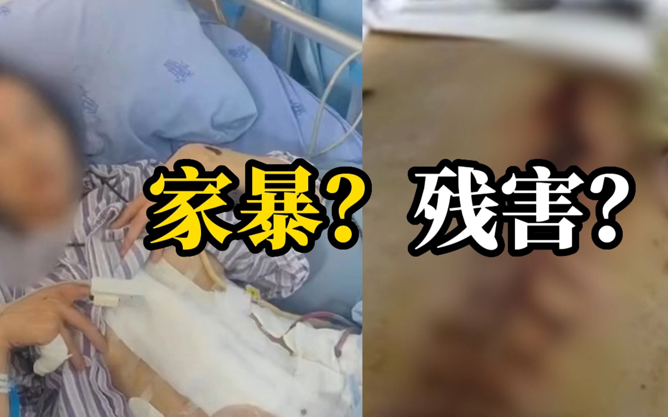 女子控诉遭丈夫长期家暴：肋骨被打断 多脏器损伤 昏迷3天险送命