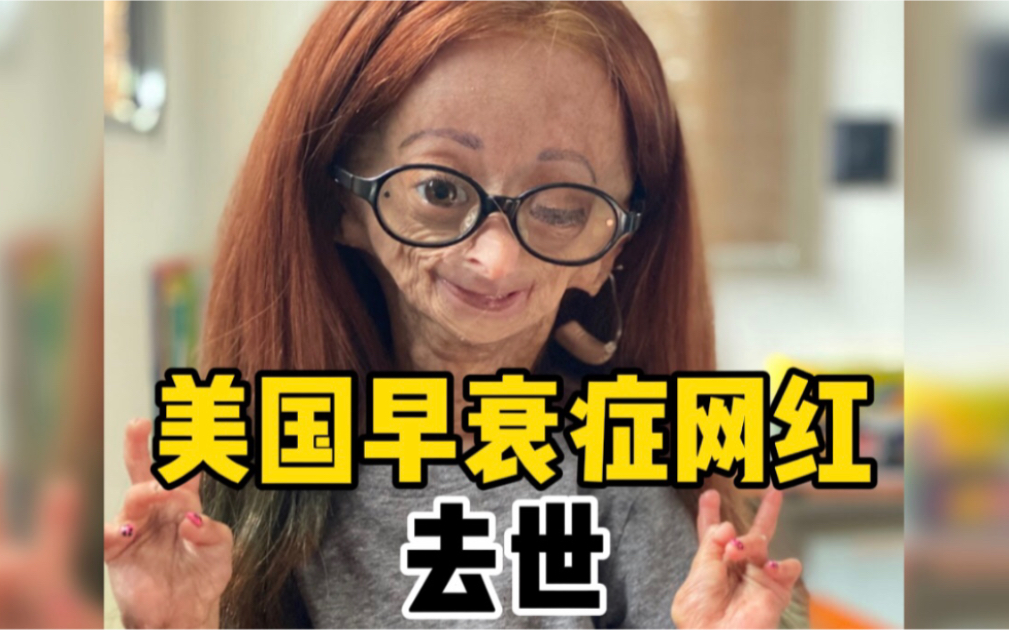 美国15岁小网红因早衰症去世：拥有1500万粉丝，美妆视频曾鼓舞无数人