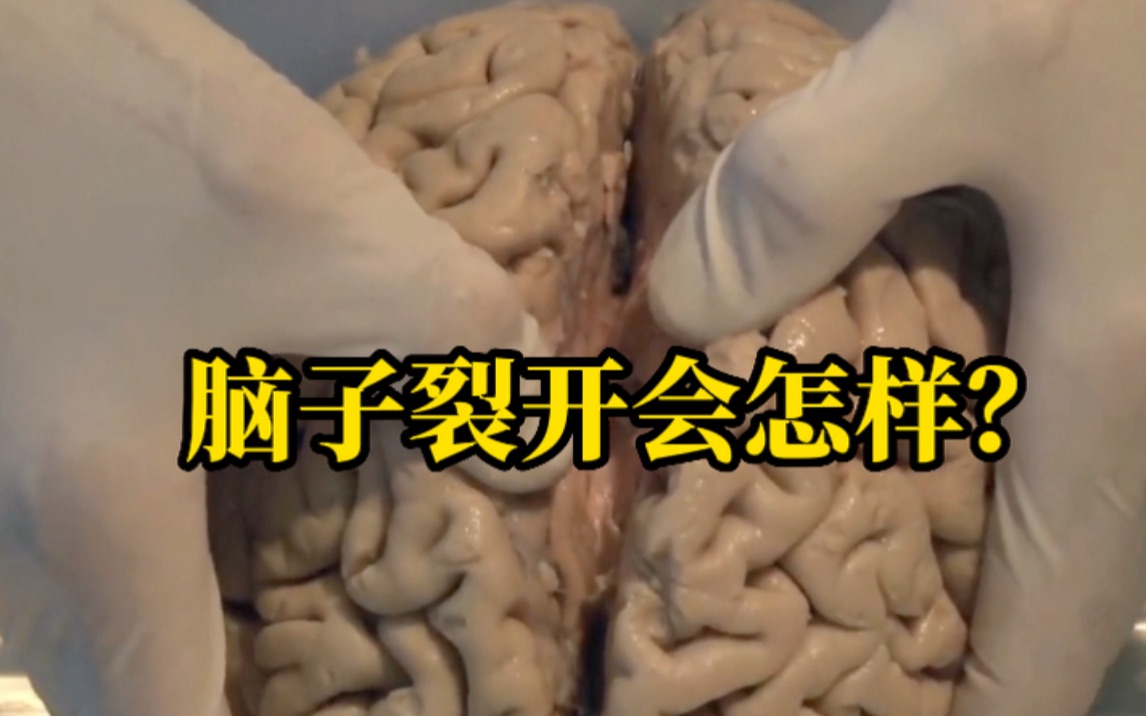 脑子裂开了会怎样，可能左右互搏直至杀死自己？