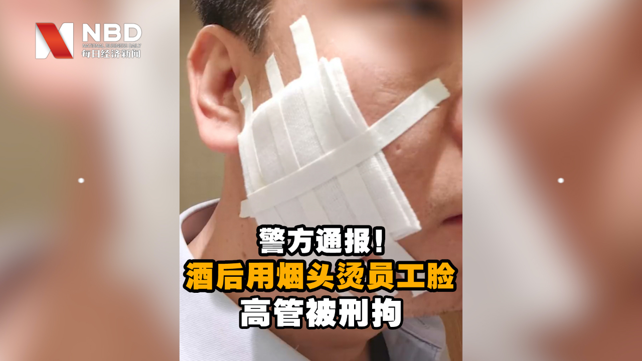 高管酒后用烟头烫员工脸！警方通报：涉事高管被刑拘