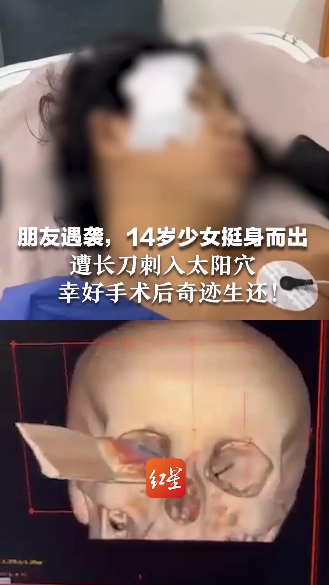 朋友遇袭，14岁少女挺身而出 遭长刀刺入太阳穴 幸好手术后奇迹生还！
