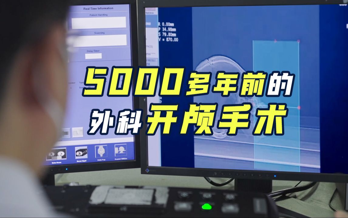 我国发现最早外科开颅手术在5000多年前