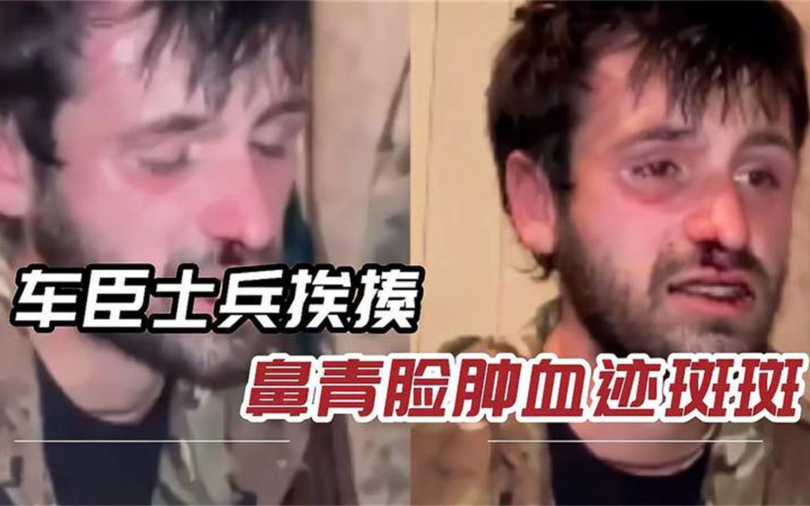 车臣“大胡子”部队，揪出泄密间谍狠狠教训，连门牙都打掉了
