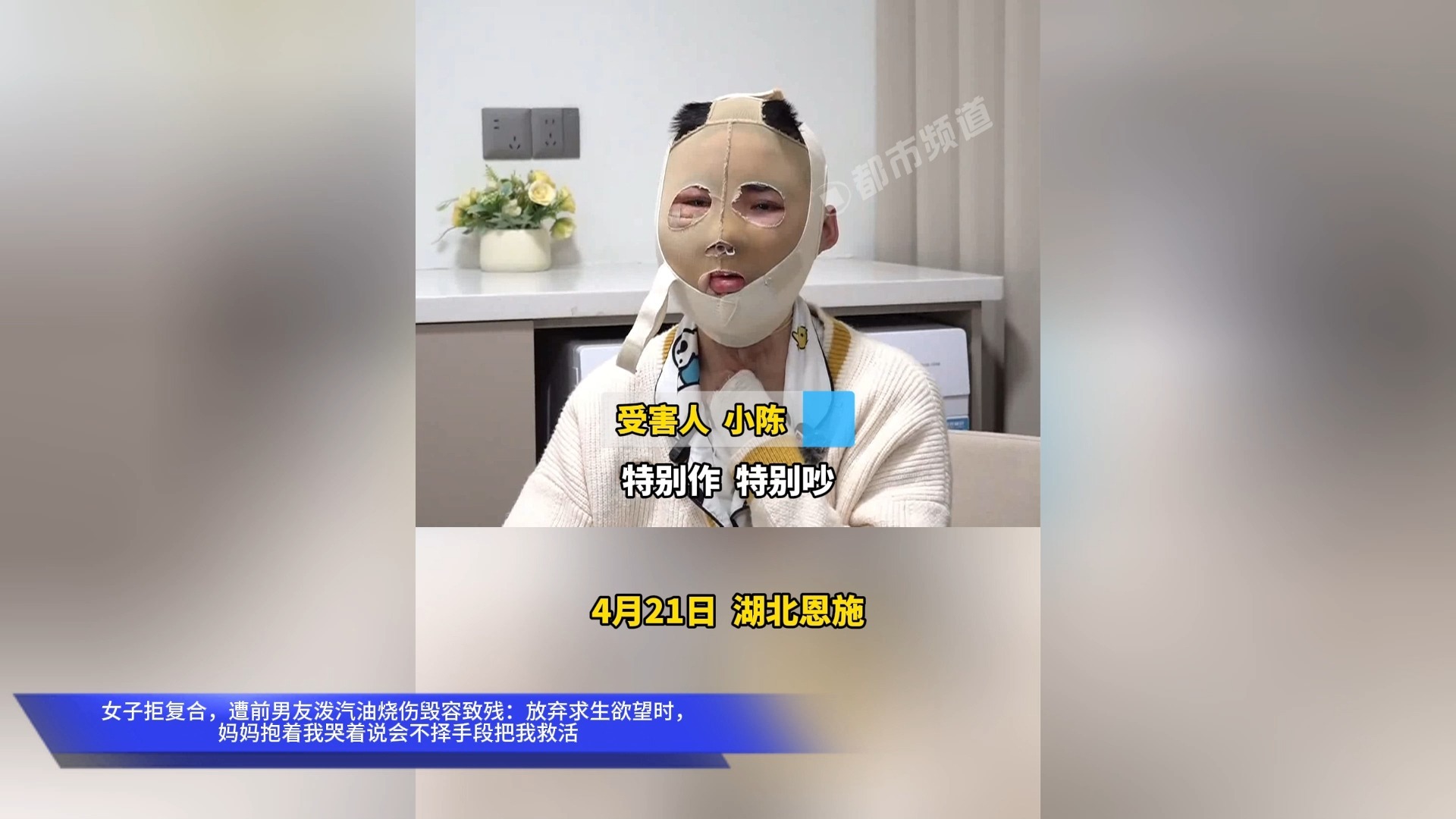 女子拒复合，遭前男友泼汽油烧伤毁容致残：放弃求生欲望时，妈妈抱着我哭着说会不择手段把我救活