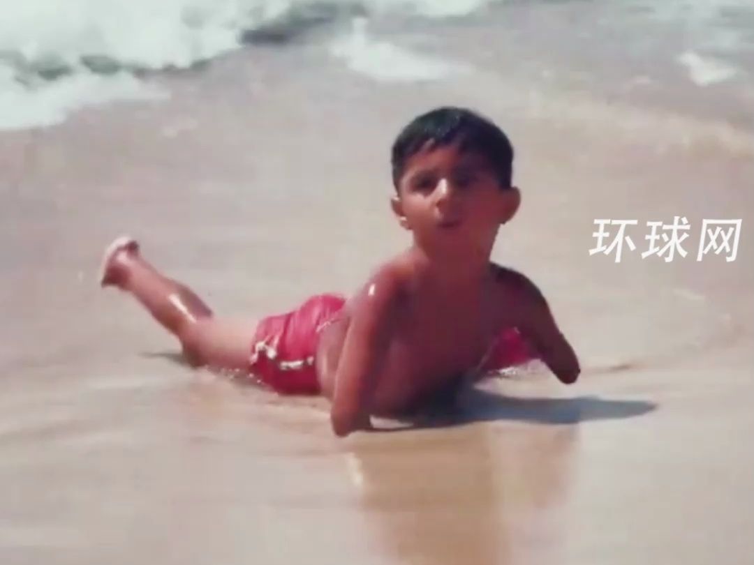 心碎一幕：因以色列空袭而截肢的巴勒斯坦男孩在加沙海滩玩耍