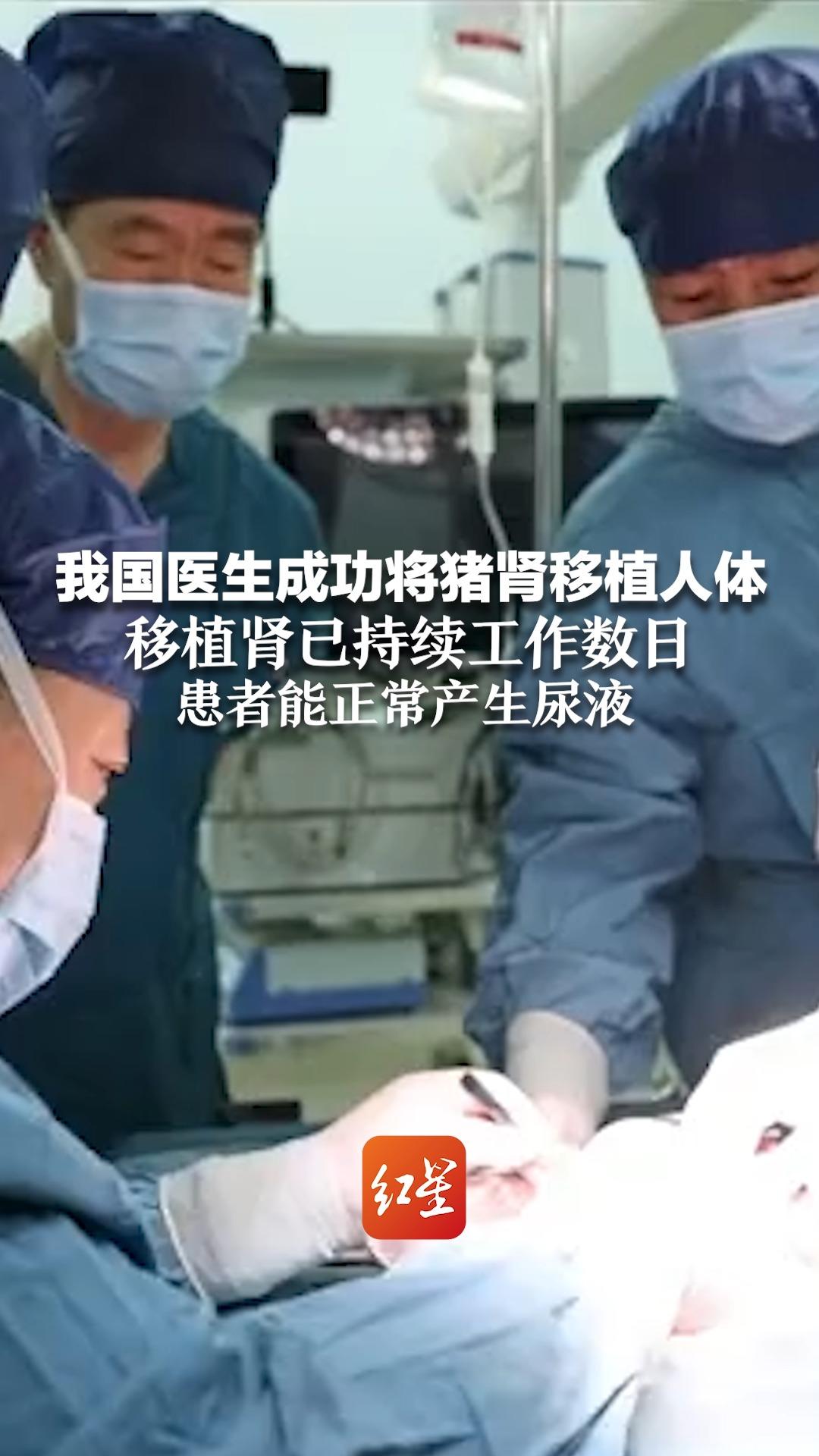 我国医生成功将猪肾移植人体 移植肾已持续工作数日 患者正常产生尿液