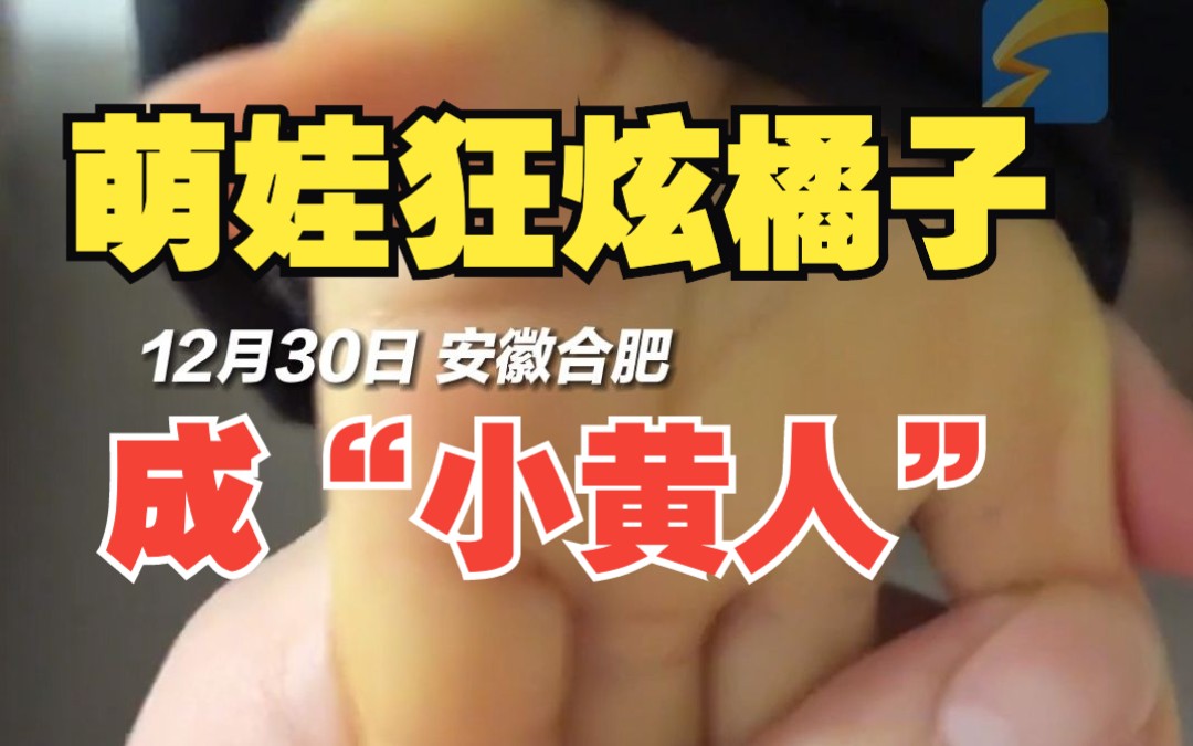 萌娃狂炫橘子两周成“小黄人” 妈妈：不敢再给他吃了