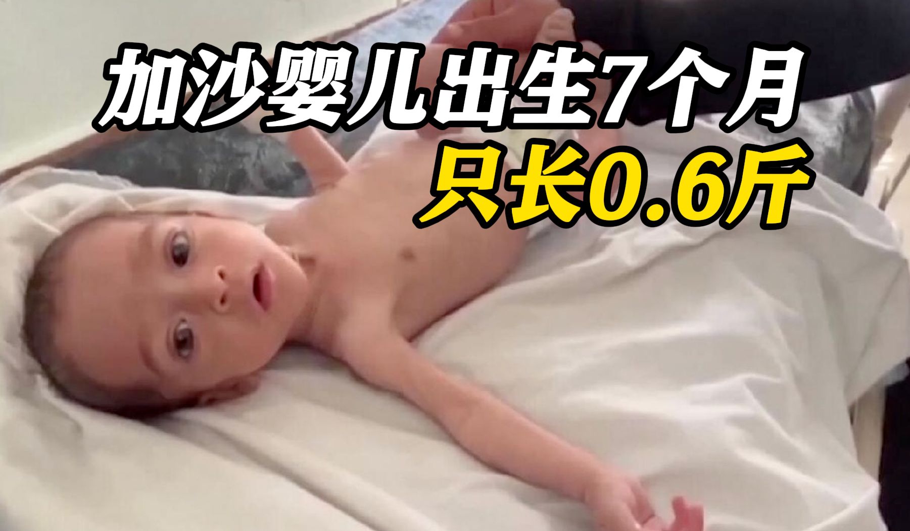 加沙婴儿只能喝过滤后的雨水 出生7个月只长0.6斤