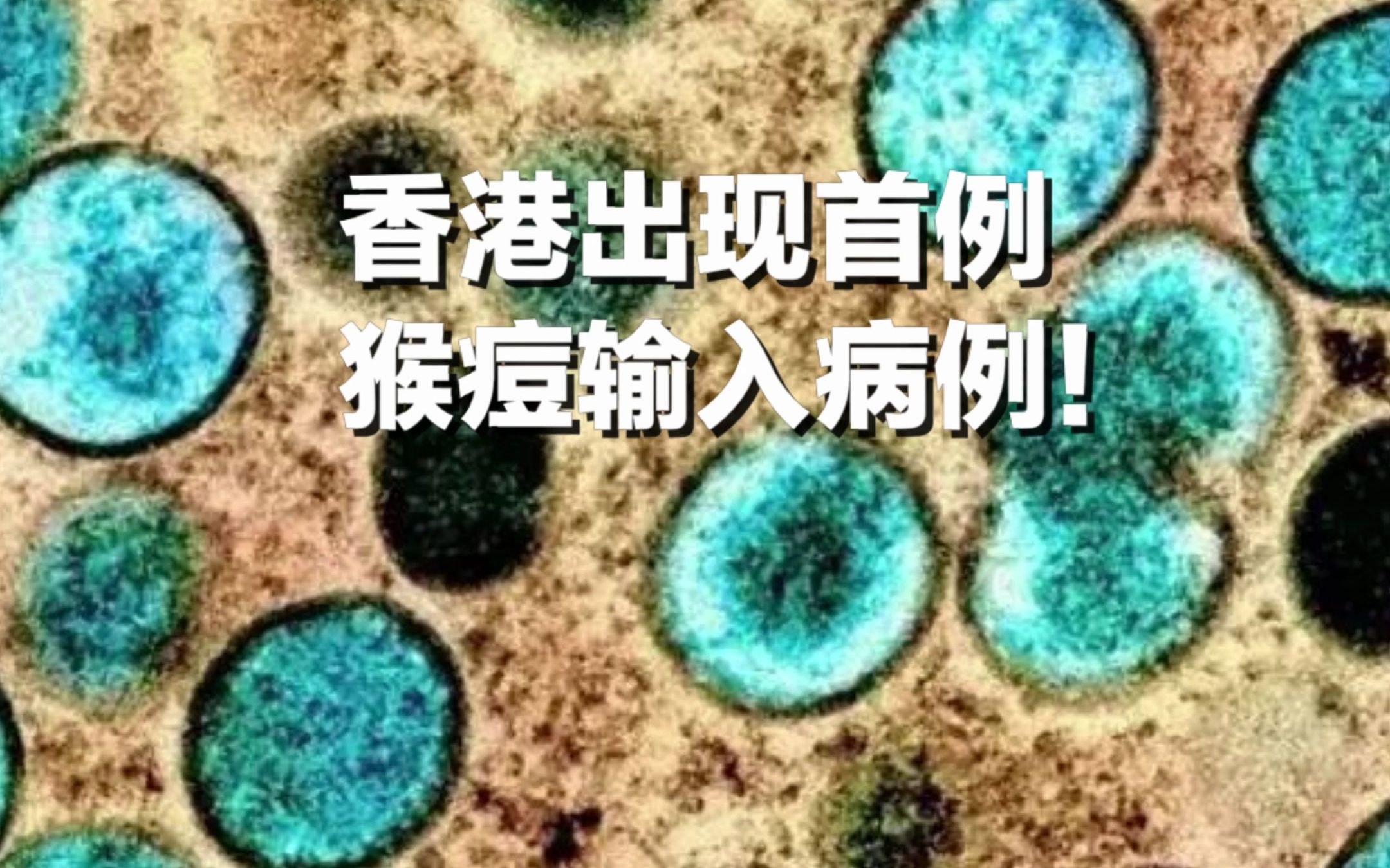 香港出现首例猴痘输入病例！