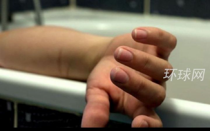 2名中国游客在印尼巴厘岛身亡：系20多岁男女，均全身赤裸