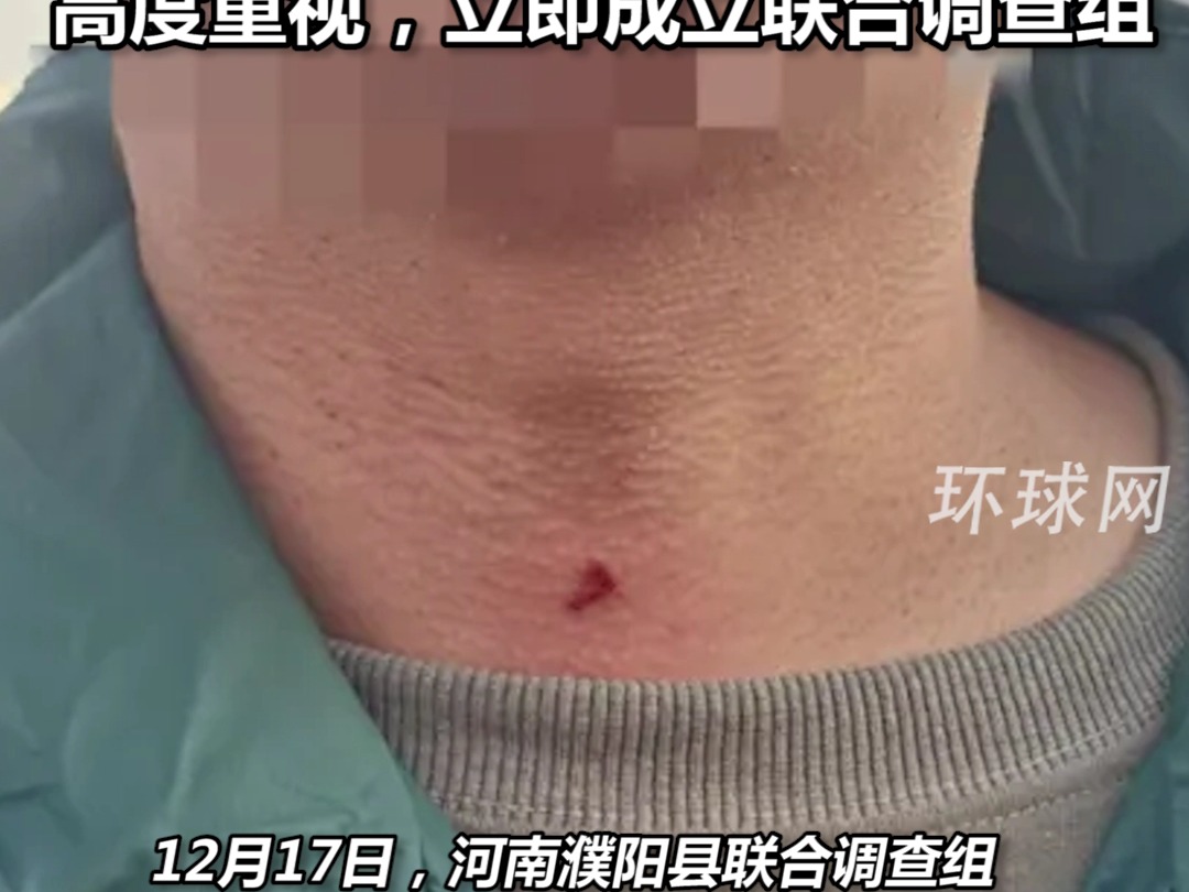 河南濮阳县通报“汇源集团员工因地租矛盾被镇政府人员殴打”：高度重视，立即成立联合调查组