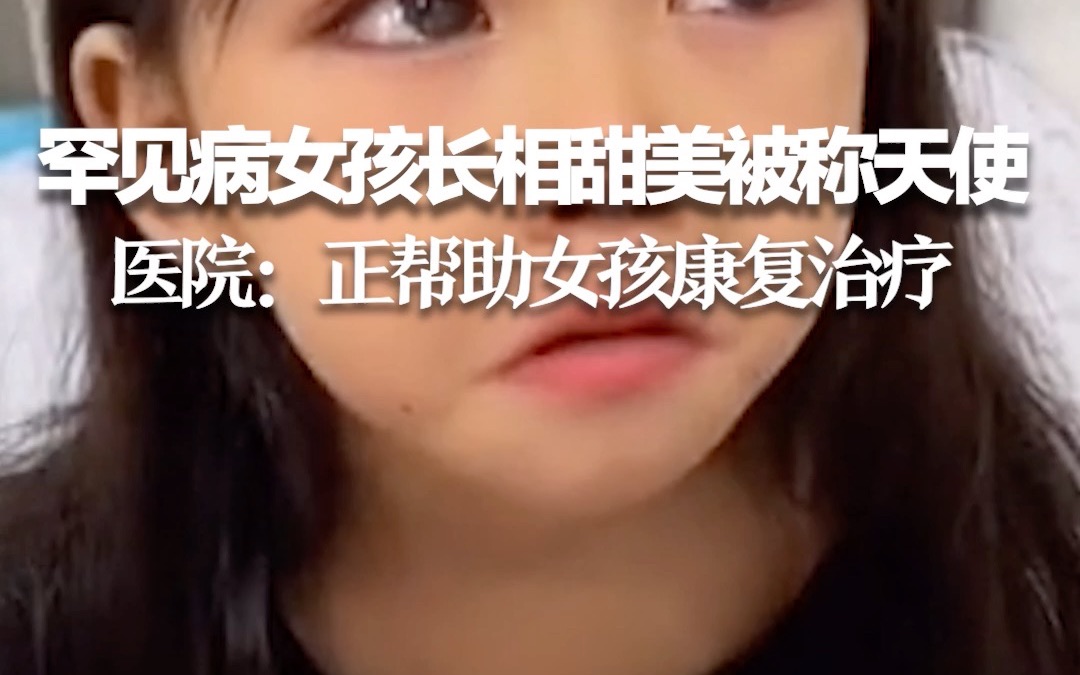 罕见病女孩长相甜美被称天使，康复中心院长：目前没有特效药，唯一的有效的手段就是康复治疗