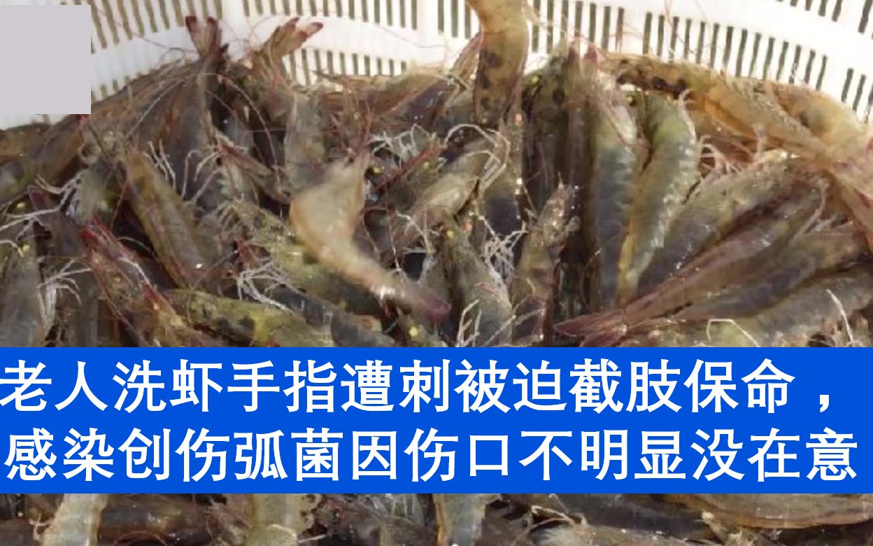 广东一八旬老人洗虾手指被刺感染，切左上肢保命